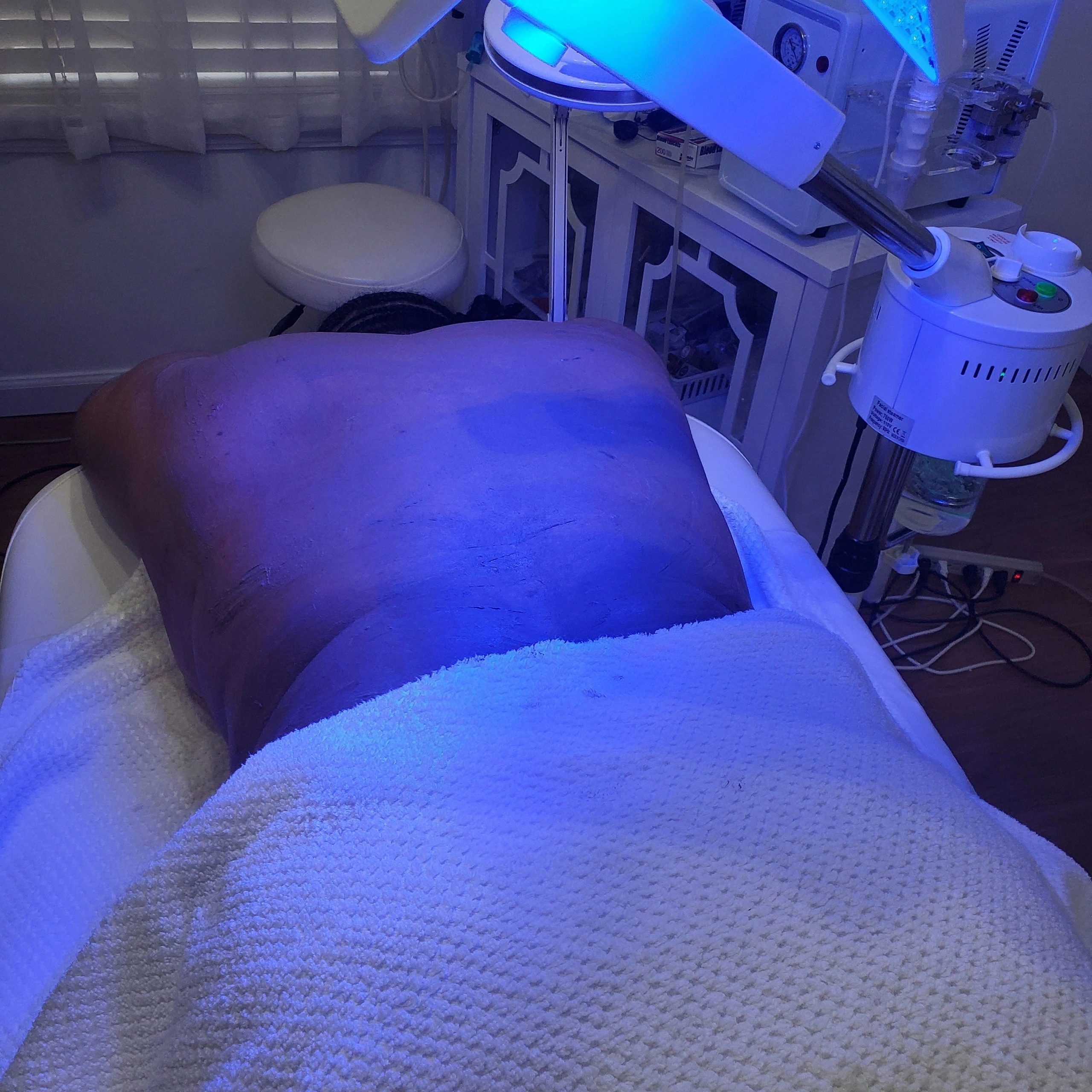 Back treatment with blue LED therapy after extractions